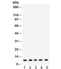 Western blot testing of 1) rat liver, 2) rat heart, 3) mouse heart, 4) human HepG2 and 5) human HeLa lysate with FXYD1 antibody. Expected/observed molecular weight ~10 kDa.