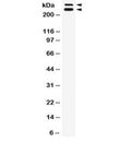 Western blot testing of rat testis lysate with WNK1 antibody. Expected molecular weight: 206-300 kDa (6 isoforms).