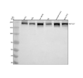 Western blot analysis of RB1CC1 using anti-RB1CC1 antibody. Electrophoresis was performed on a 8% SDS-PAGE gel at 80V (Stacking gel) / 120V (Resolving gel) for 2 hours. Lane 1: human K562 whole cell lysates, Lane 2: human HEL whole cell lysates, Lane 3: rat testis tissue lysates, Lane 4: rat C6 whole cell lysates, Lane 5: mouse testis tissue lysates, Lane 6: mouse NIH/3T3 whole cell lysates. After electrophoresis, proteins were transferred to a nitrocellulose membrane at 150 mA for 50-90 min.