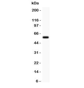 Western blot testing of TdT antibody and Jurkat lysate. Predicted molecular weight: ~56 kDa.