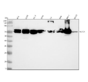 Western blot analysis of NETO1 using anti-NETO1 antibody. Lane 1: human RT4 whole cell lysates, Lane 2: human U20S whole cell lysates, Lane 3: human PC-3 whole cell lysates, Lane 4: human SIHA whole cell lysates, Lane 5: rat C6 whole cell lysates, Lane 6: rat NRK whole cell lysates, Lane 7: mouse RM-1 whole cell lysates, Lane 8: mouse SP2/0 whole cell lysates. After electrophoresis, proteins were transferred to a nitrocellulose membrane at 150 mA for 50-90 min.