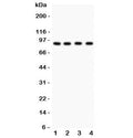 Western blot testing of Furin antibody and Lane 1: HeLa; 2: MCF-7; 3: COLO320; 4: SW620. Observed molecular weight 90~110 kDa (precusor/mature may be glycosylated).