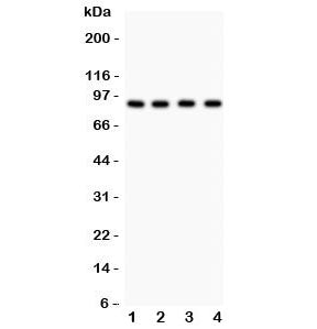 Western blot testing of Furin antibody and Lane 1: HeLa; 2: MCF-7; 3: COLO320; 4: SW620. Observed molecular weight 90~110 kDa (precusor/mature may be glycosylated).