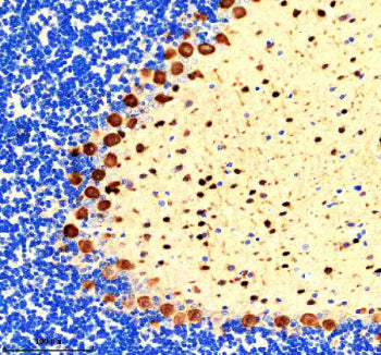IHC staining of FFPE rat cerebellum tissue with PVALB antibody, HRP-secondary and DAB substrate. HIER: boil tissue sections in pH8 EDTA for 20 min and allow to cool before testing.