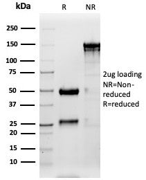 SDS-PAGE analysis of purified, BSA-free Surfactant Protein D antibody (clone SFTPD/4362) as confirmation of integrity and purity.
