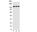 Western blot testing of TLR10 antibody and Lane 1: HeLa; 2: Jurkat; 3: CEM cell lysate. Observed size: 95-130KD, depending on glycosylation level