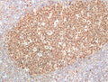 IHC staining of FFPE human tonsil tissue with recombinant Ribonuclease H2 subunit B antibody at 1:100.