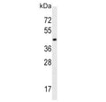 Western blot testing of human K562 cell lysate with MCT10 antibody. Predicted molecular weight ~55 kDa.
