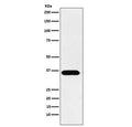 Western blot testing of human A431 cell lysate with ACP5 antibody. Predicted molecular weight ~36 kDa.