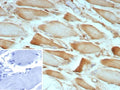 IHC staining of FFPE human skeletal muscle tissue with ZNF408A antibody (clone ZNF804A/8945). Inset: PBS used in place of primary Ab (secondary Ab negative control). HIER: boil tissue sections in pH 9 10mM Tris with 1mM EDTA for 20 min and allow to cool before testing.