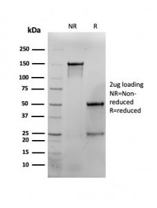 SDS-PAGE analysis of purified, BSA-free Interferon gamma antibody (clone G-23) as confirmation of integrity and purity.