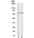 Western blot testing of HepG2 [A] and K562 [B] lysates with CYP2B6 antibody at 0.1ug/ml. Predicted molecular weight: ~56kDa, observed here at ~75kDa.
