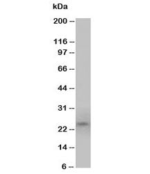 Western blot testing of PrP antibody and U87 cell lysate (human glioma). Expected molecular weight: 20~29kDa.