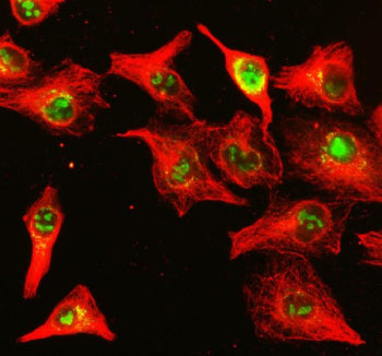 Immunofluorescent staining of NUP85 using anti-NUP85 antibody (green) and anti-Beta Tubulin antibody (red). NUP85 was detected in an immunocytochemical section of cells. Enzyme antigen retrieval was performed using IHC enzyme antigen retrieval reagent for 15 mins. The cells were blocked with 10% goat serum. And then incubated with 5 ug/ml rabbit anti-NUP85 antibody and mouse anti-Beta Tubulin antibody overnight at 4oC.