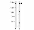 Western blot analysis of lysate from human K562 and mouse F9 cell line using Dnmt1 antibody at 1:1000. Predicted molecular weight: 180-200 kDa