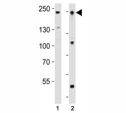 Western blot analysis of lysate from human K562 and mouse F9 cell line using Dnmt1 antibody at 1:1000. Predicted molecular weight: 180-200 kDa