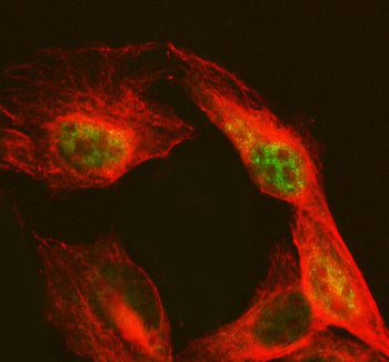 Immunofluorescent staining of NAB2 using anti-NAB2 antibody (green) and anti-Beta Tubulin antibody (red). NAB2 was detected in an immunocytochemical section of U2OS cells. Enzyme antigen retrieval was performed using IHC enzyme antigen retrieval reagent for 15 mins. The cells were blocked with 10% goat serum. And then incubated with 5 ug/ml rabbit anti-NAB2 antibody and mouse anti-Beta Tubulin antibody overnight at 4oC.