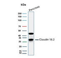 Western blot testing of human pancreas tissue lysate with Claudin18.2 antibody. Predicted molecular weight ~28 kDa.