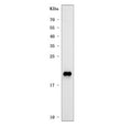 Western blot testing of human A431 cell lysate with CLDN1 antibody. Expected molecular weight: 20-23 kDa.