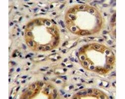 CXCR3 antibody immunohistochemistry analysis in formalin fixed and paraffin embedded human kidney tissue.