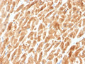 IHC staining of FFPE cardiac muscle with Dystrophin antibody (clone DMD/3242). HIER: boil tissue sections in pH 9 10mM Tris with 1mM EDTA for 20 min and allow to cool before testing.