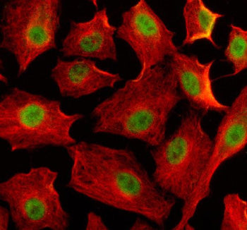 Immunofluorescent staining of EIF4A3 using anti-EIF4A3 antibody (green) and anti-Beta Tubulin antibody (red). EIF4A3 was detected in an immunocytochemical section of human A549 cells. Enzyme antigen retrieval was performed using IHC enzyme antigen retrieval reagent for 15 mins. The cells were blocked with 10% goat serum. And then incubated with 5 ug/ml rabbit anti-EIF4A3 antibody and mouse anti-Beta Tubulin antibody overnight at 4oC.