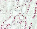 IHC testing of FFPE human kidney tissue with Sm-D3 antibody. HIER: steam section in pH6 citrate buffer for 20 min and allow to cool prior to staining.