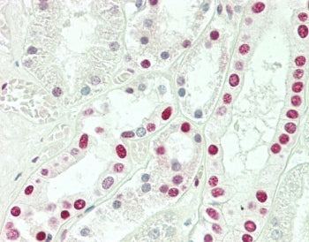 IHC testing of FFPE human kidney tissue with Sm-D3 antibody. HIER: steam section in pH6 citrate buffer for 20 min and allow to cool prior to staining.