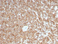 IHC staining of FFPE human spleen with GMCSF antibody (clone CSF2/3403). HIER: boil tissue sections in pH 9 10mM Tris with 1mM EDTA for 10-20 min and allow to cool before testing.
