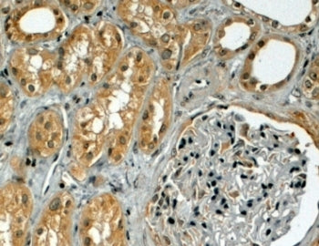IHC testing of FFPE human kidney with TRIM5 antibody at 4ug/ml. HIER: steamed with pH6 citrate buffer, HRP-staining.