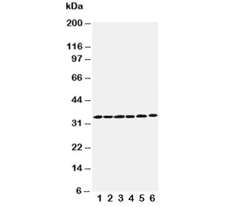 Western blot testing of Cyclin D1 antibody and Lane 1: rat testis; 2: rat ovary; 3: rat brain; 4: HeLa; 5: MM231; 6: SW620 cell lysate. Predicted molecular weight: 32-36 kDa.