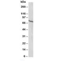 Western blot testing of Estrogen receptor antibody and MCF-7 lysate (human breast cancer line). Predicted molecular weight: 53~59 kDa.