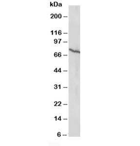 Western blot testing of Estrogen receptor antibody and MCF-7 lysate (human breast cancer line). Predicted molecular weight: 53~59 kDa.