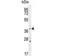 Western blot testing of mouse lung lysate with Twinfilin 2 antibody. Predicted molecular weight ~39 kDa.