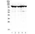 Western blot testing of human 1) HEK293, 2) HEK293 (different lot), 3) HeLa, 4) COLO-320, 5) T-47D and 6) A549 cell lysate with MSH2 antibody. Expected molecular weight: ~105 kDa.