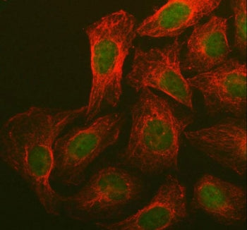 Immunofluorescent staining of FFPE human U-2 OS cells with BRCA1 antibody (green) and Beta Tubulin mAb (red). HIER: steam section in pH6 citrate buffer for 20 min.