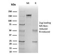 SDS-PAGE analysis of purified, BSA-free IL1B antibody (clone IL1B/465) as confirmation of integrity and purity.
