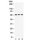 Western blot testing of human 1) 293, 2) A549 and 3) PANC cell lysate with KCNA5 antibody. Expected/observed molecular weight ~67 kDa.