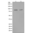 Western blot testing with MMP9 antibody. Expected molecular weight: ~92 kDa (precursor), 67-80 kDa (mature).