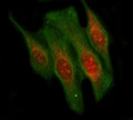 Immunofluorescent staining of FFPE human HeLa cells with LIN9 antibody (red) and Beta Tubulin mAb (green). HIER: steam section in pH6 citrate buffer for 20 min.