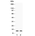 Western blot testing of human 1) COLO320 and 2) A549 lysate with Eotaxin antibody Predicted molecular weight ~11 kDa.
