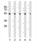Western blot testing of NFKBIE antibody at 1:2000 dilution. Lane 1: PC3 lysate; 2: A375 lysate; 3: HeLa lysate; 4: LNCaP lysate; 5: THP-1 lysate; Predicted band size : 53 kDa.