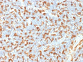 IHC testing of FFPE human lymph node with IBA1 antibody (clone AIF1/1909). HIER: boil tissue sections in pH6, 10mM citrate buffer, for 10-20 min followed by cooling at RT for 20 min.