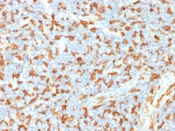 IHC testing of FFPE human lymph node with IBA1 antibody (clone AIF1/1909). HIER: boil tissue sections in pH6, 10mM citrate buffer, for 10-20 min followed by cooling at RT for 20 min.