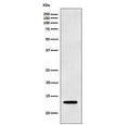 Western blot testing of human K562 cell lysate with LGALS1 antibody. Predicted molecular weight ~14 kDa.