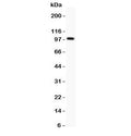 Western blot testing of Prothrombin antbody and rat testis lysate; Predicted molecular weight: 70 kDa, but may be observed at higher molecular weights due to glycosylation.