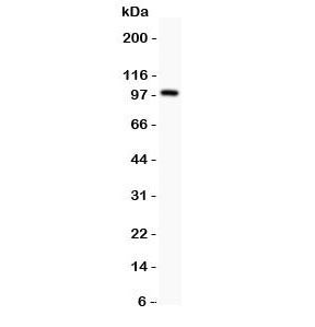 Western blot testing of Prothrombin antbody and rat testis lysate; Predicted molecular weight: 70 kDa, but may be observed at higher molecular weights due to glycosylation.