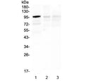 Western blot testing of 1) human Caco-2, 2) rat brain and 3) mouse brain lysate with HECTD3 antibody at 0.5ug/ml. Predicted molecular weight ~97 kDa.