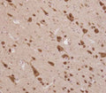 IHC testing of FFPE human brain tissue with ELAVL2 antibody. HIER: steam section in pH6 citrate buffer for 20 min and allow to cool prior to staining.
