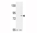 Western blot analysis of FGFR1 antibody and 293 cell lysate (2 ug/lane) either nontransfected (Lane 1) or transiently transfected with the FGFR1 gene (2). Predicted molecular weight: 75-160 kDa depending on glycosylation level.